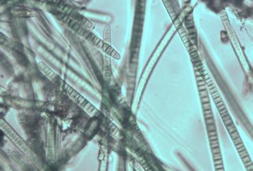 Blue-green_algae_Phormidum_nigrum.jpg